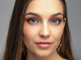 Headshot of woman after skin laser treatments