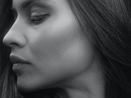 Black and white, close up of young woman's face showing potential results from injectables