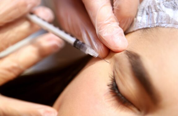 A patient gets botox injectables to treat crow's feet