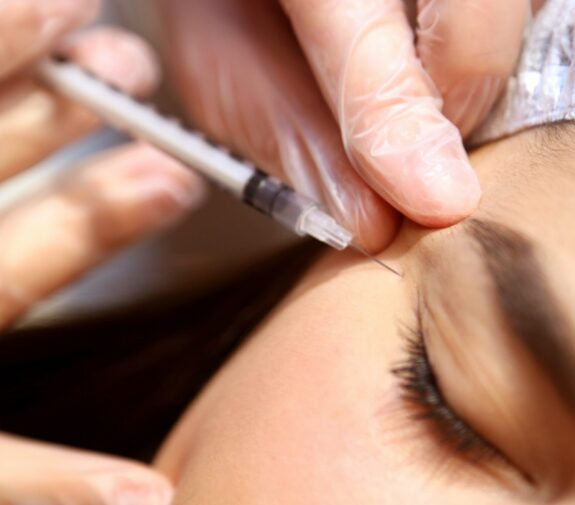 A patient gets botox injectables to treat crow's feet